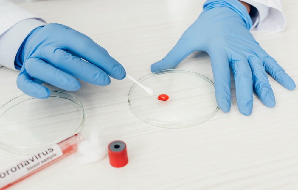 Does Immunotherapy Raise White Blood Cell Count?